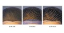 Cofia tipo red detectable